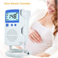 Springbud - SpringBud FD-350B Fetal Doppler Heart Beat Monitor